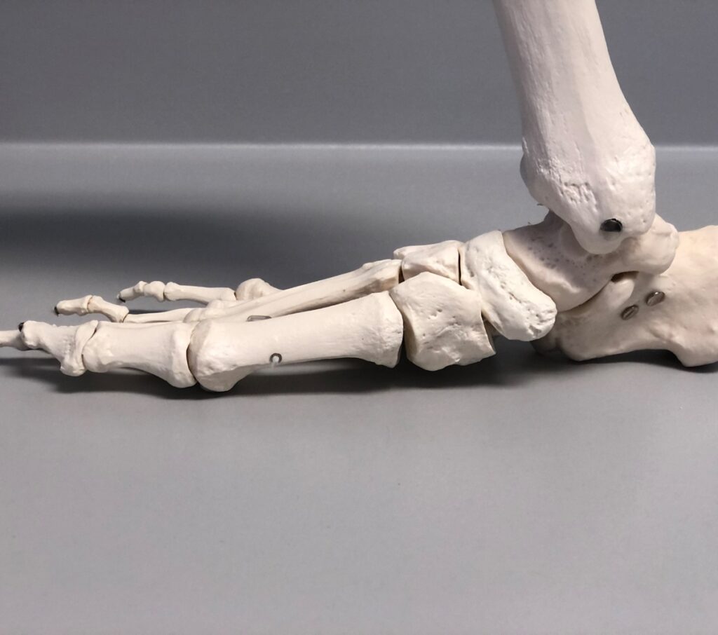 Flat Feet, Flat Feet Surgery Belmont Anderson DPM Las Vegas Podiatrist