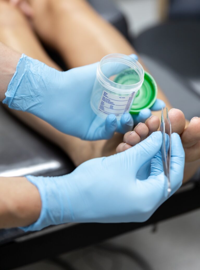 Skin Lesions and Foot & Ankle Dermatology, Skin Biopsy Belmont